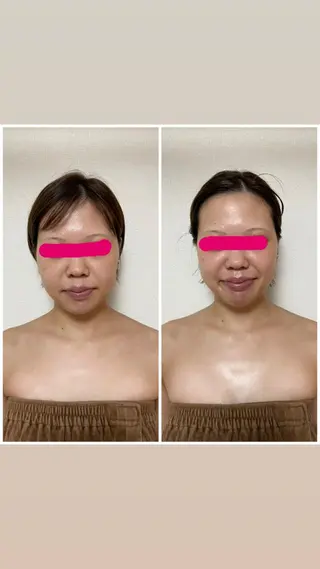 透明感の肌Lino malieのエステ・リラクイメージ