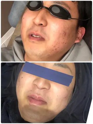 クラスペディア脱毛 ・フェイシャル専門店のエステ・リラクイメージ