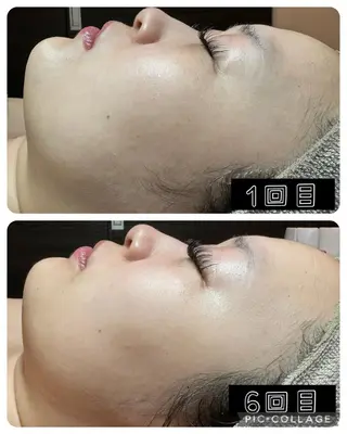 エステ✖️ネイル Feelのネイルデザイン