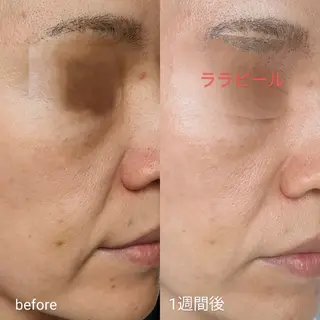 ナスサロ️ 看護師️🫧山口のエステ・リラクイメージ