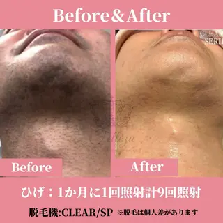 メンズ 有人型セルフサロン 脱毛/痩身/美顔のその他イメージ