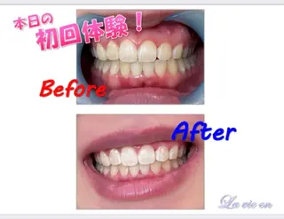 セルフホワイトニングサロン　ラヴィアン所属・ホワイトニングサロン La vie enのその他イメージ