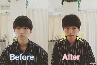 鍼灸整骨院Refine所属・鍼灸 Refineのその他イメージ