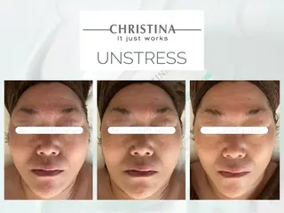 肌質改善|天王寺 For...はるかのエステ・リラクイメージ