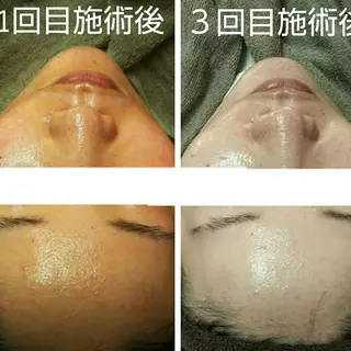 小顔と美肌 まごころエステMatoria所属・小顔 美肌専門 Matoriaのエステ・リラクイメージ