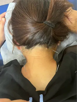 【鍼灸サロン にった】所属・はりきゅう整体 新田鍼灸院のエステ・リラクイメージ