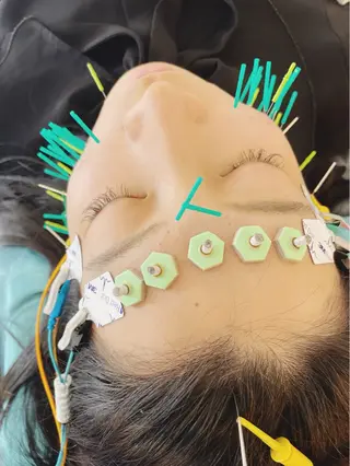 小顔美容鍼専門サロン 渋谷YZのエステ・リラクイメージ