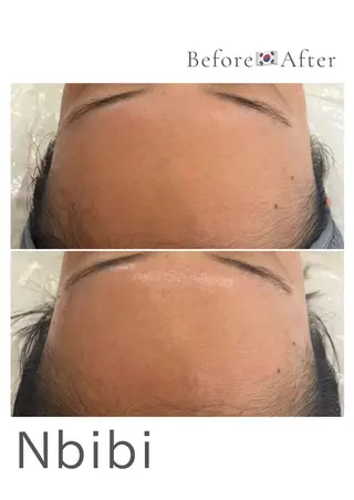 韓国🇰🇷価格 サロン_Nbibiのエステ・リラクイメージ