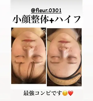FLEUR フルール所属・FLEUR🫧 フェイシャルのエステ・リラクイメージ