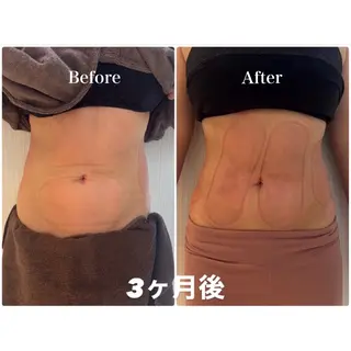 脂肪冷却痩身サロン SHIFT 東京のエステ・リラクイメージ