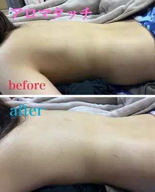 アロマ･美容鍼･カッ ピング「麗」鍼灸院のエステ・リラクイメージ