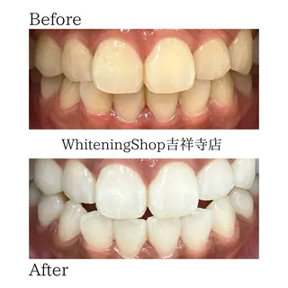 ホワイトニング専門店 御殿山/吉祥寺店のその他イメージ