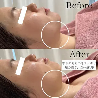 lafleur Yurinaのエステ・リラクイメージ