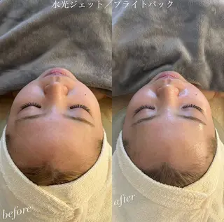 うなじ脱毛/美肌脱毛 LABELのエステ・リラクイメージ