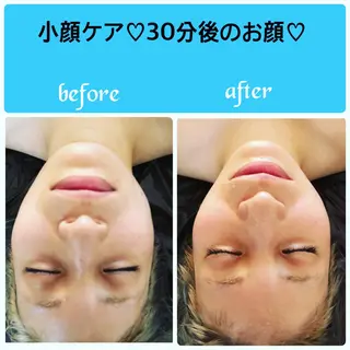 FLEUR大阪・美容 整体・痩身・小顔のエステ・リラクイメージ