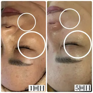 WHITE AQUA 北千住店のエステ・リラクイメージ