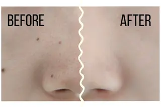 Rainy みたけ店のマツエク・マツパデザイン