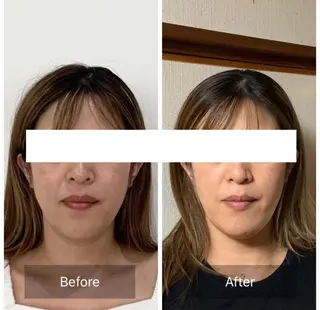 小顔と ヘッドスパのお店のエステ・リラクイメージ