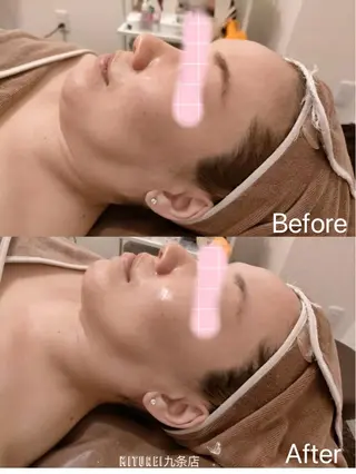 西区九条エステ MITUREIサロンのエステ・リラクイメージ