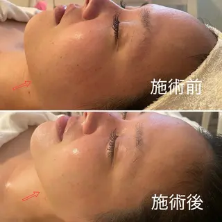 ビューティーサロン ソナタのエステ・リラクイメージ