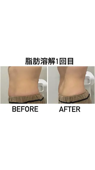 毛穴洗浄・痩身・脱毛 /アルカンジュのエステ・リラクイメージ