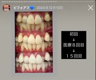Kaula所属・Kaula セルフホワイトニングのその他イメージ