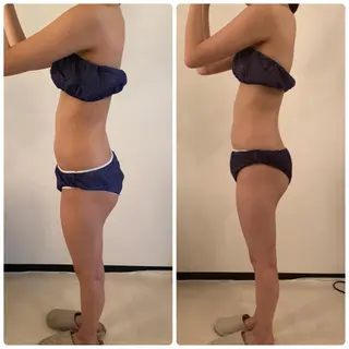 FLEUR大阪・整体 ・ハイフ・痩身・小顔のエステ・リラクイメージ