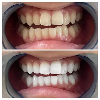 セミロング パーマ キッズ アイブロウ マツエク・マツパ メンズ カラー ヘアアレンジ ネイル ライトビューティー 銀座店のエステ・リラクイメージ