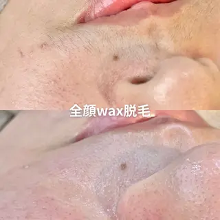 EST BEAUTY所属・顔専門ワックス脱毛/ ハーブピーリングのエステ・リラクイメージ