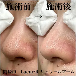 大久保 里奈のエステ・リラクイメージ