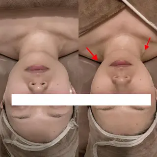 西区九条エステ MITUREIサロンのエステ・リラクイメージ