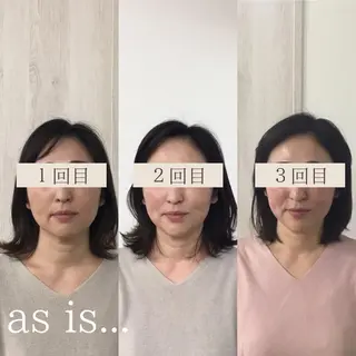 小顔専門アズイズ ビューティー　草津店のエステ・リラクイメージ