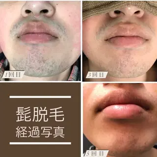 メンズ Lilyboo 池袋のエステ・リラクイメージ