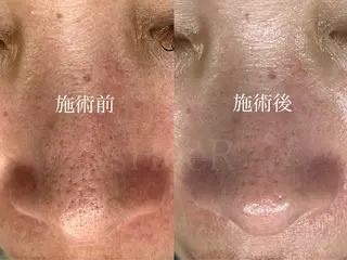 sHeeR【シアー】 ハマナカのマツエク・マツパデザイン