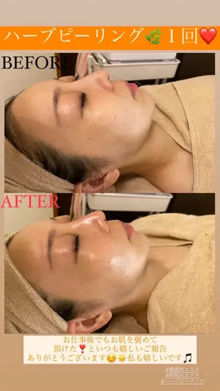 Salon de Lino 御器所のエステ・リラクイメージ