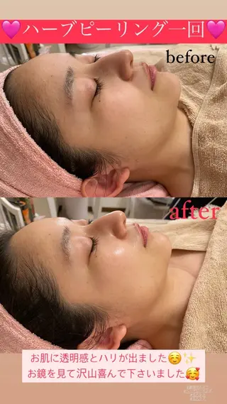 メンズ Salon de Lino 御器所のエステ・リラクイメージ