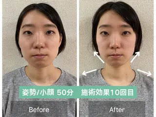 美容整体　小顔矯正 プラスフィール石松のエステ・リラクイメージ