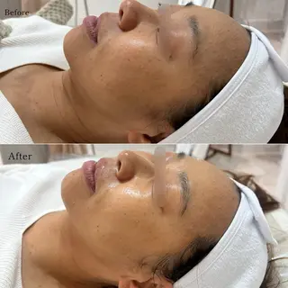 〈etre〉トータルビューティーサロン所属・etre - 韓国肌管理 -のエステ・リラクイメージ