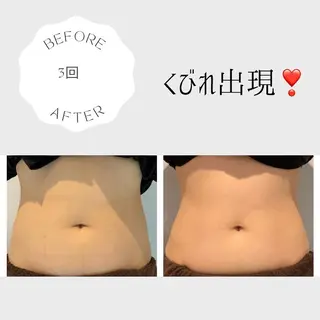 癒し腸もみサロン シャユーム　ゆきなのエステ・リラクイメージ