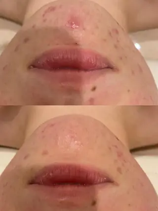 本格エステの ヘッドスパのその他イメージ