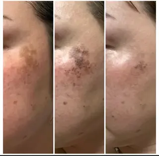 salon merci和泉のエステ・リラクイメージ