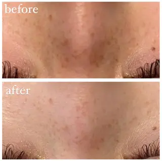 TotalBeautySalon UNCHEL所属・Ito ayakaのその他イメージ