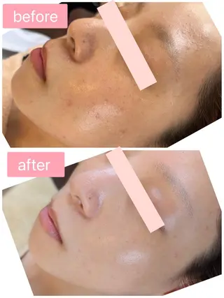 Monart -deux-のエステ・リラクイメージ