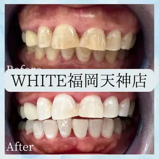メンズ ホワイトニング専門店 WHITE天神店のエステ・リラクイメージ