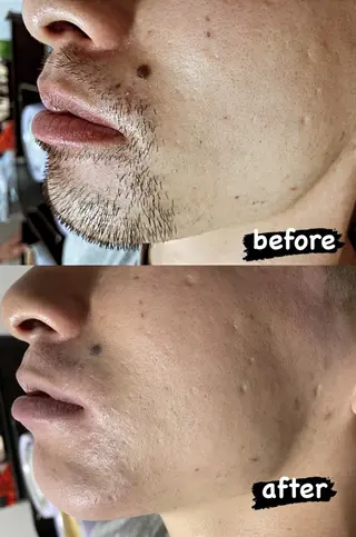 メンズ Epina 千葉店 【エピナ】のエステ・リラクイメージ