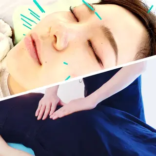 小顔美容鍼専門サロン 渋谷YZのエステ・リラクイメージ