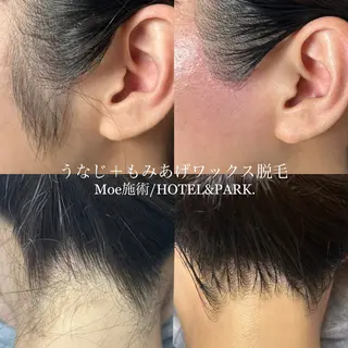 HOTEL&PARK .Moeワックス脱毛のエステ・リラクイメージ