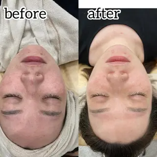 laluna saki...のその他イメージ