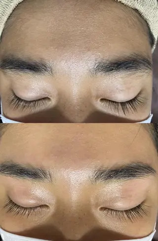 キッズ メンズ Epina 千葉店 【エピナ】のエステ・リラクイメージ