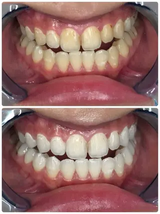 ホワイトニングサロンaile所属・セルフホワイトニング 金城しおりのその他イメージ